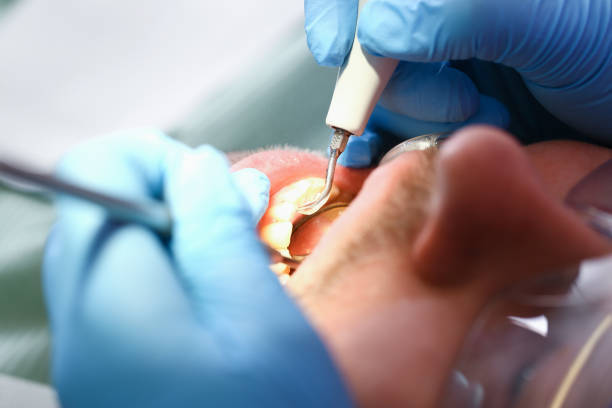 Best Emergency Treatment for Oral Infections in Wharton, TX